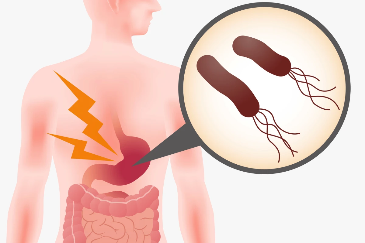 ピロリ菌専門外来